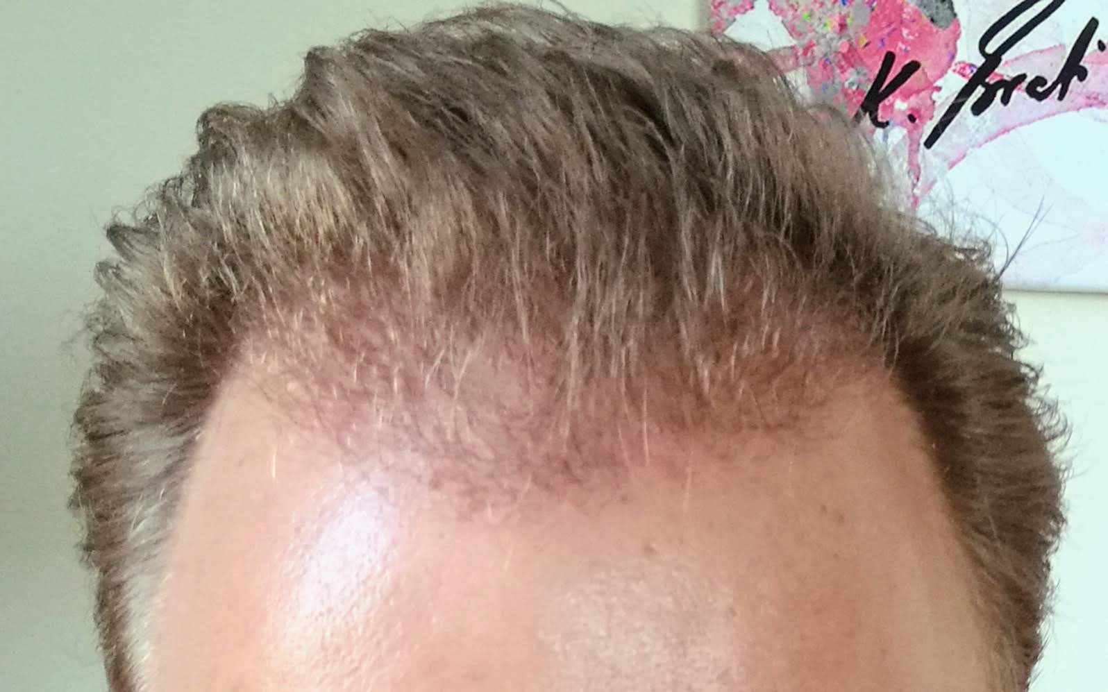 /foren/transplant/index.php?t=getfile&id=42314&private=0