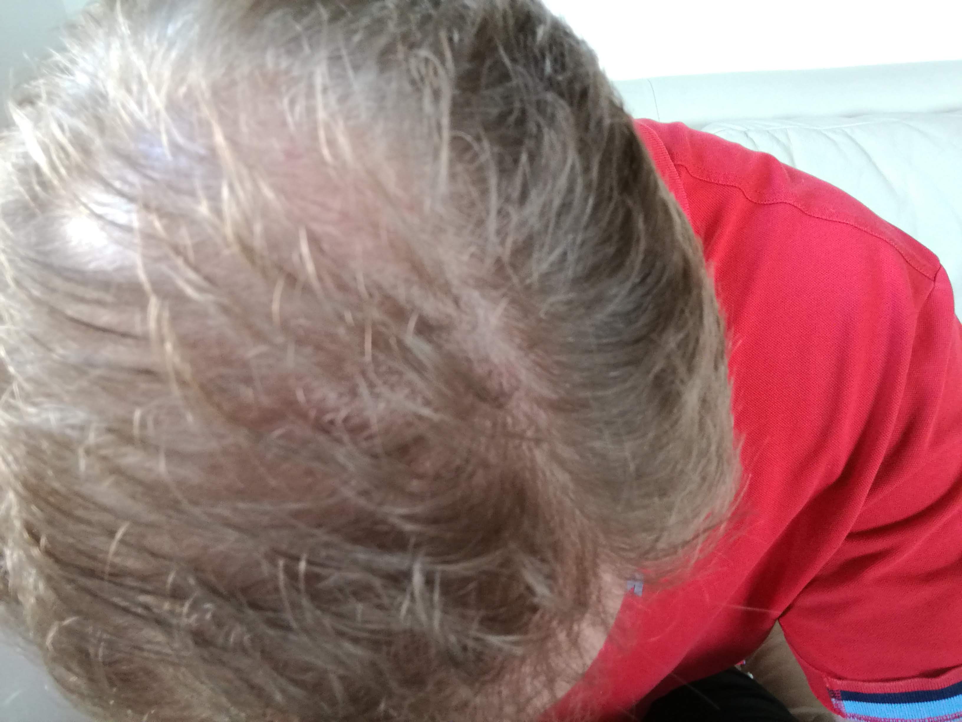 /foren/transplant/index.php?t=getfile&id=42315&private=0