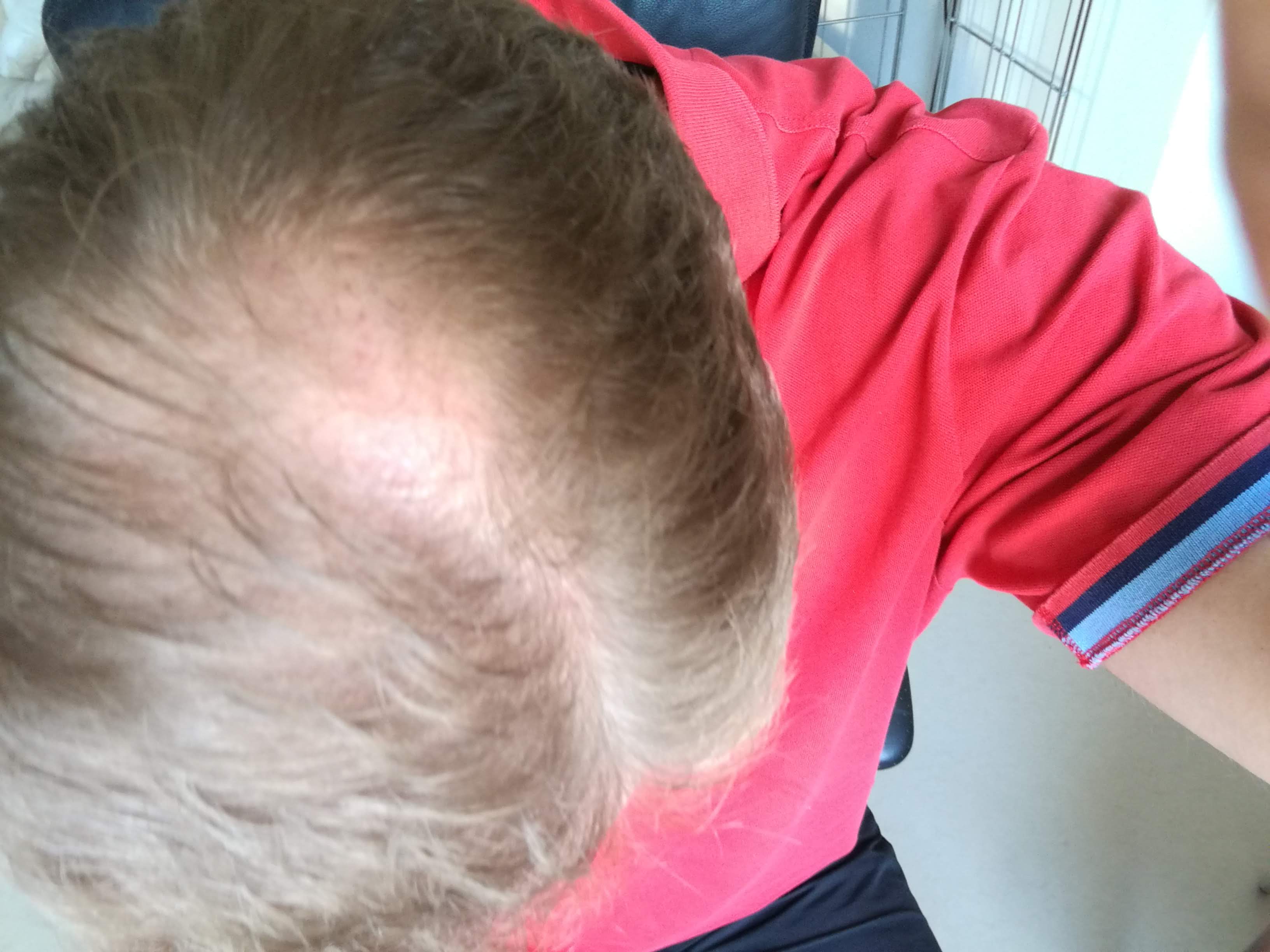 /foren/transplant/index.php?t=getfile&id=42318&private=0