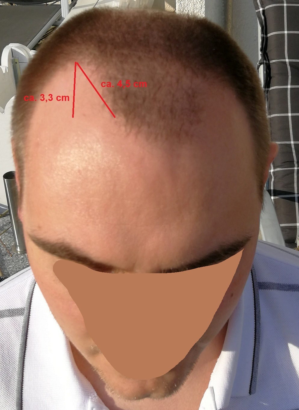 /foren/transplant/index.php?t=getfile&id=42360&private=0