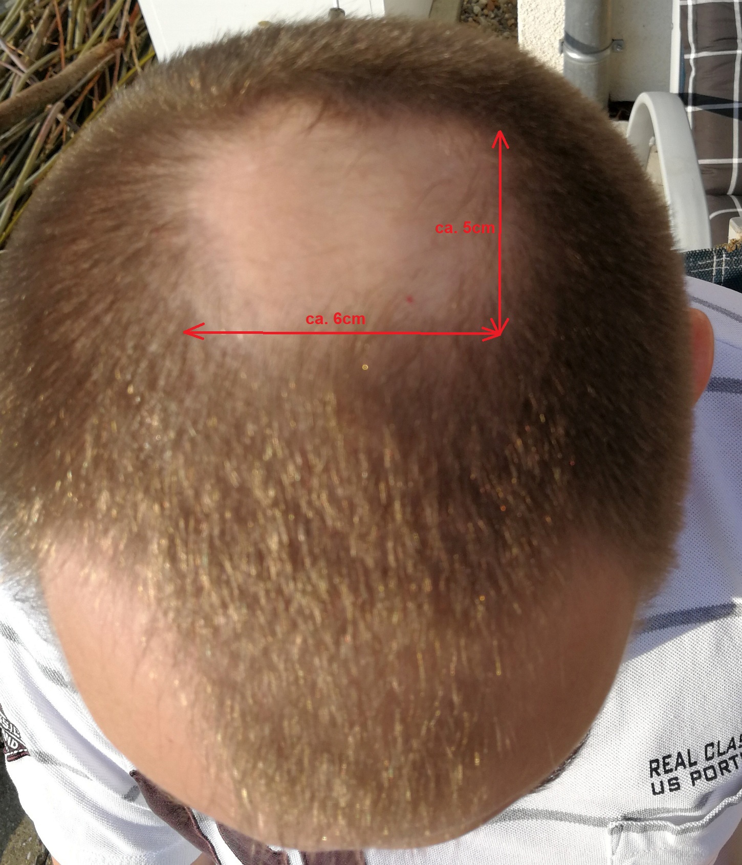 /foren/transplant/index.php?t=getfile&id=42361&private=0