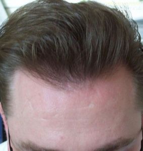 /foren/transplant/index.php?t=getfile&id=42397&private=0