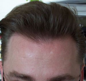 /foren/transplant/index.php?t=getfile&id=42398&private=0