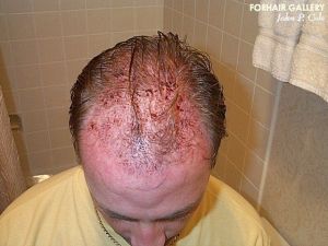 /foren/transplant/index.php?t=getfile&id=42399&private=0