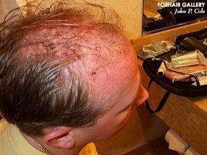 /foren/transplant/index.php?t=getfile&id=42400&private=0