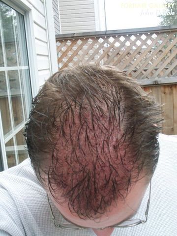 /foren/transplant/index.php?t=getfile&id=42401&private=0