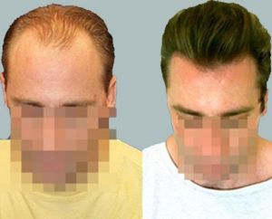 /foren/transplant/index.php?t=getfile&id=42402&private=0