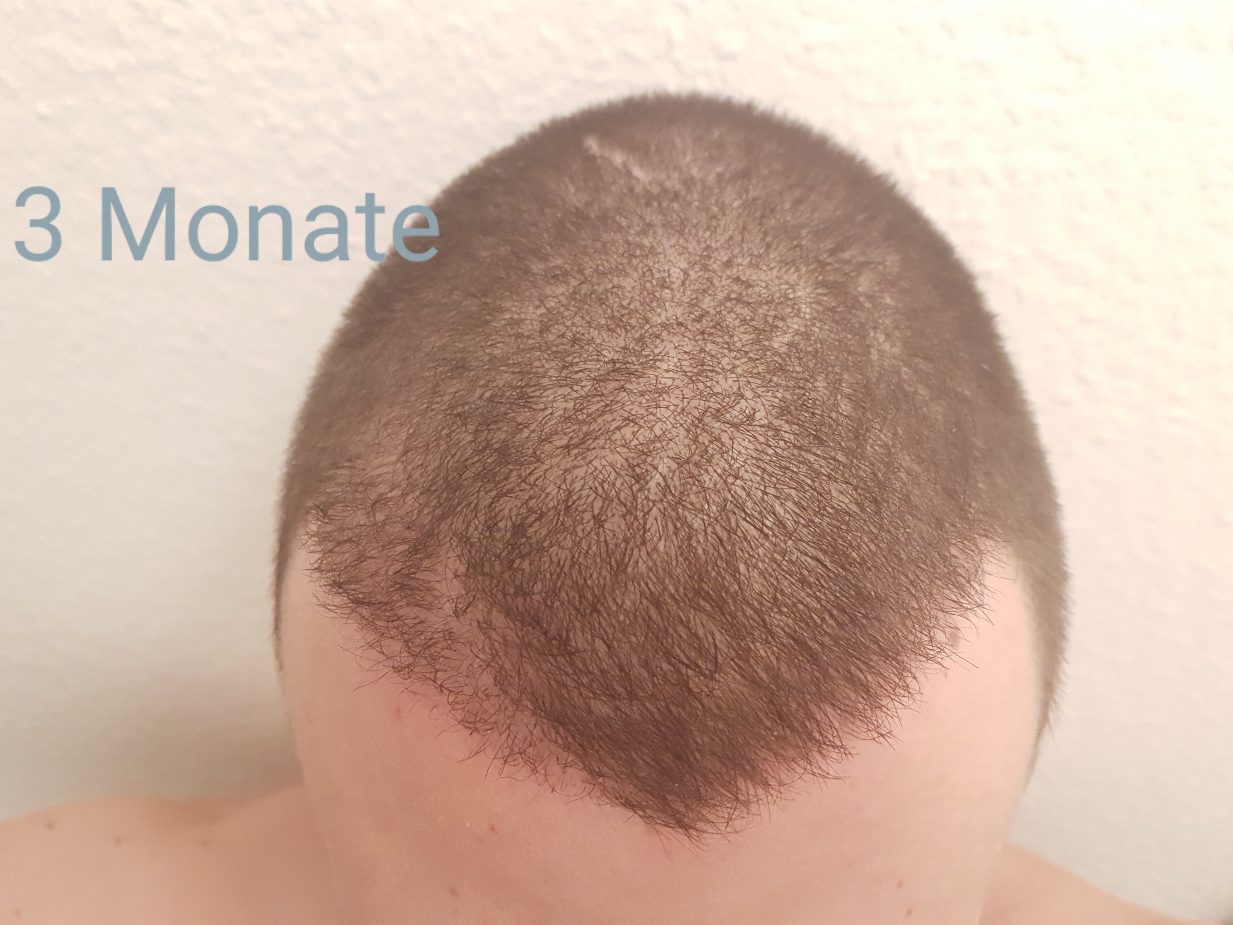 /foren/transplant/index.php?t=getfile&id=42433&private=0