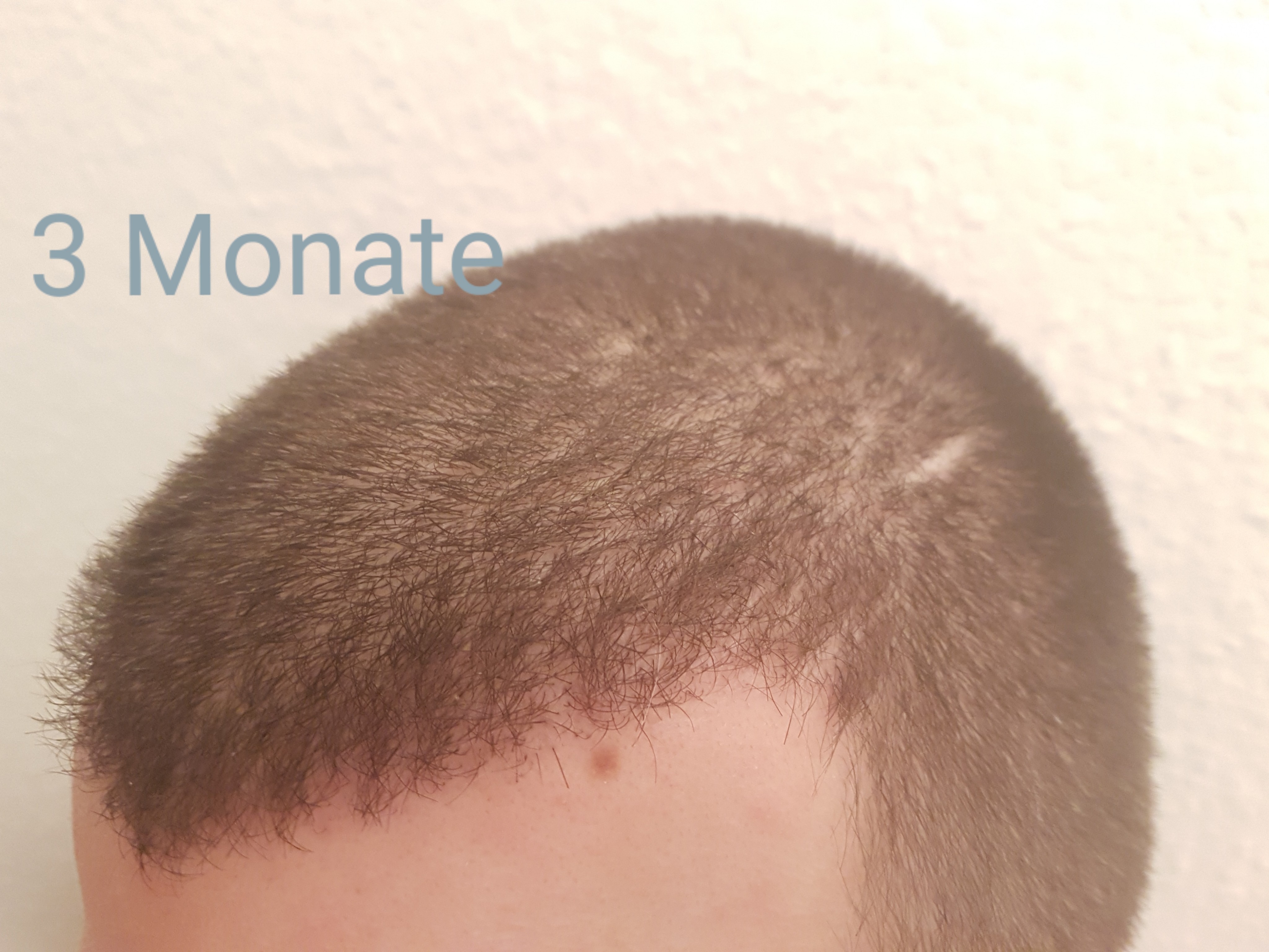 /foren/transplant/index.php?t=getfile&id=42435&private=0