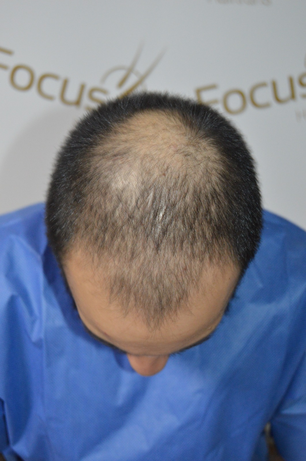 /foren/transplant/index.php?t=getfile&id=42585&private=0