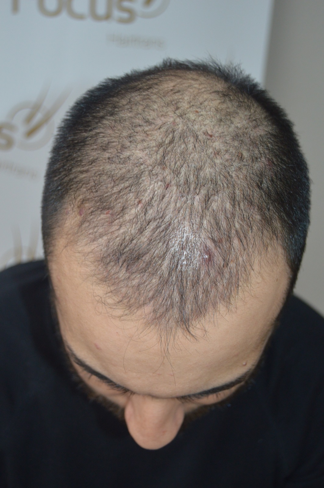 /foren/transplant/index.php?t=getfile&id=42595&private=0