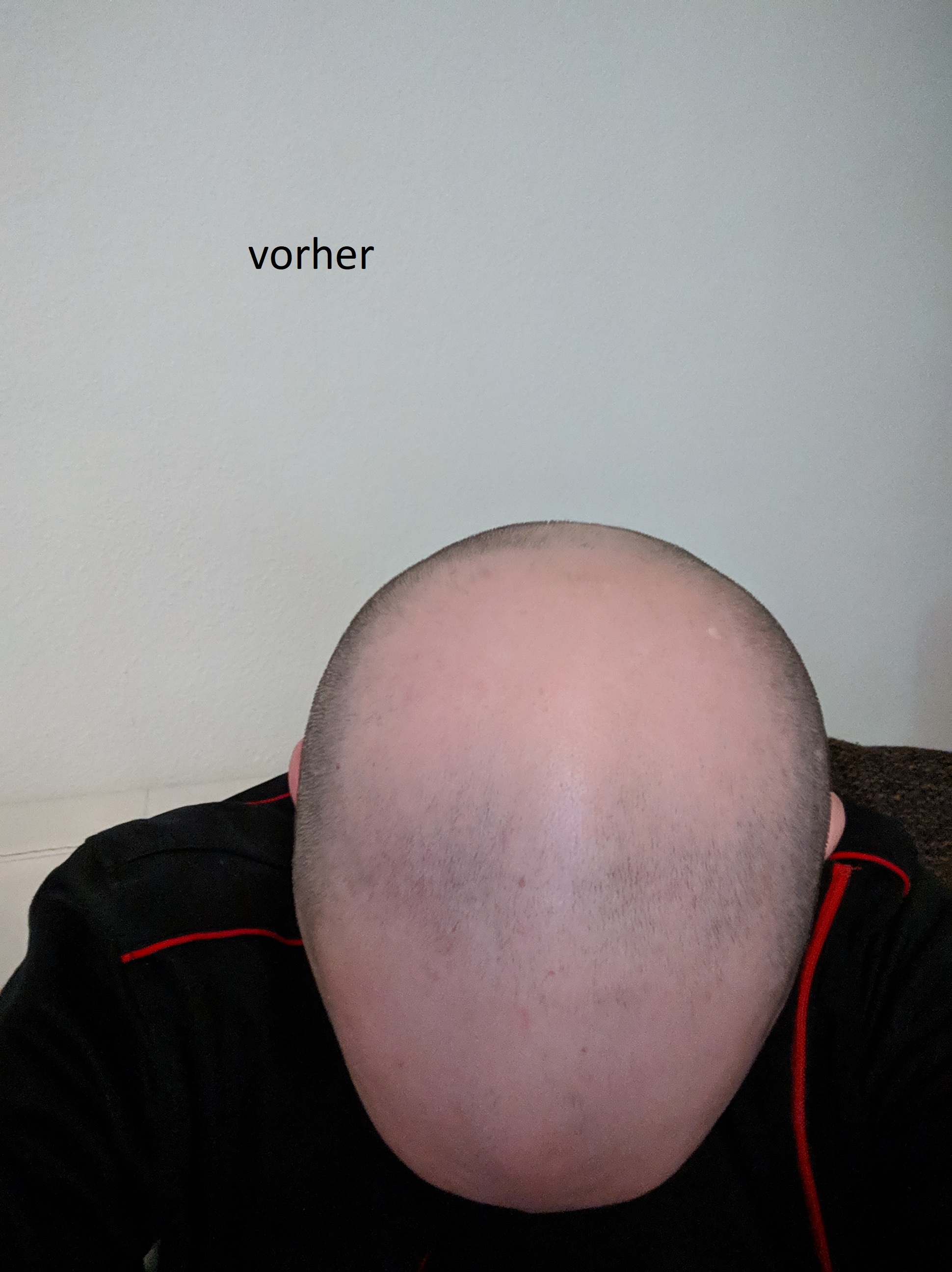 /foren/transplant/index.php?t=getfile&id=42601&private=0