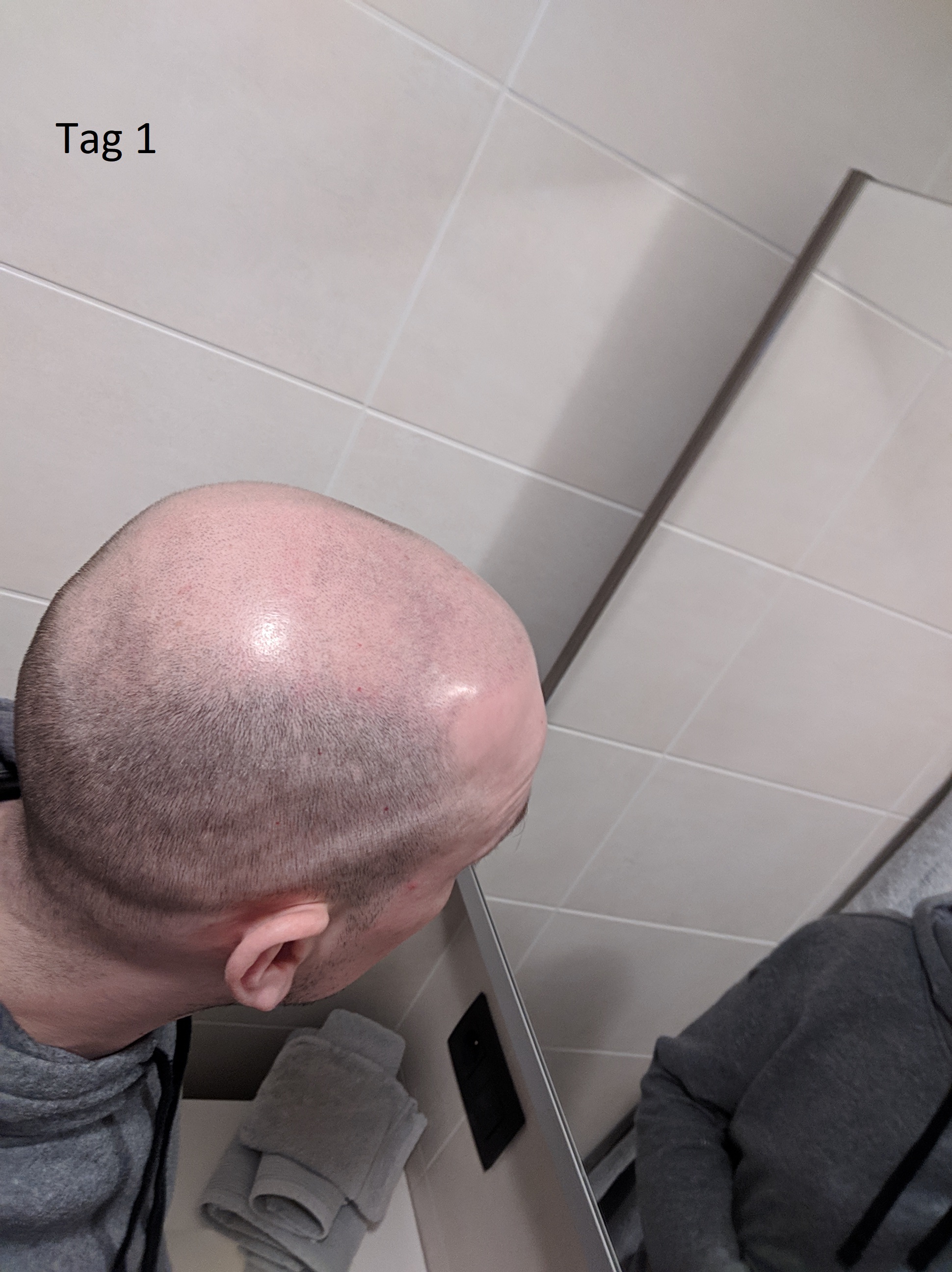 /foren/transplant/index.php?t=getfile&id=42603&private=0