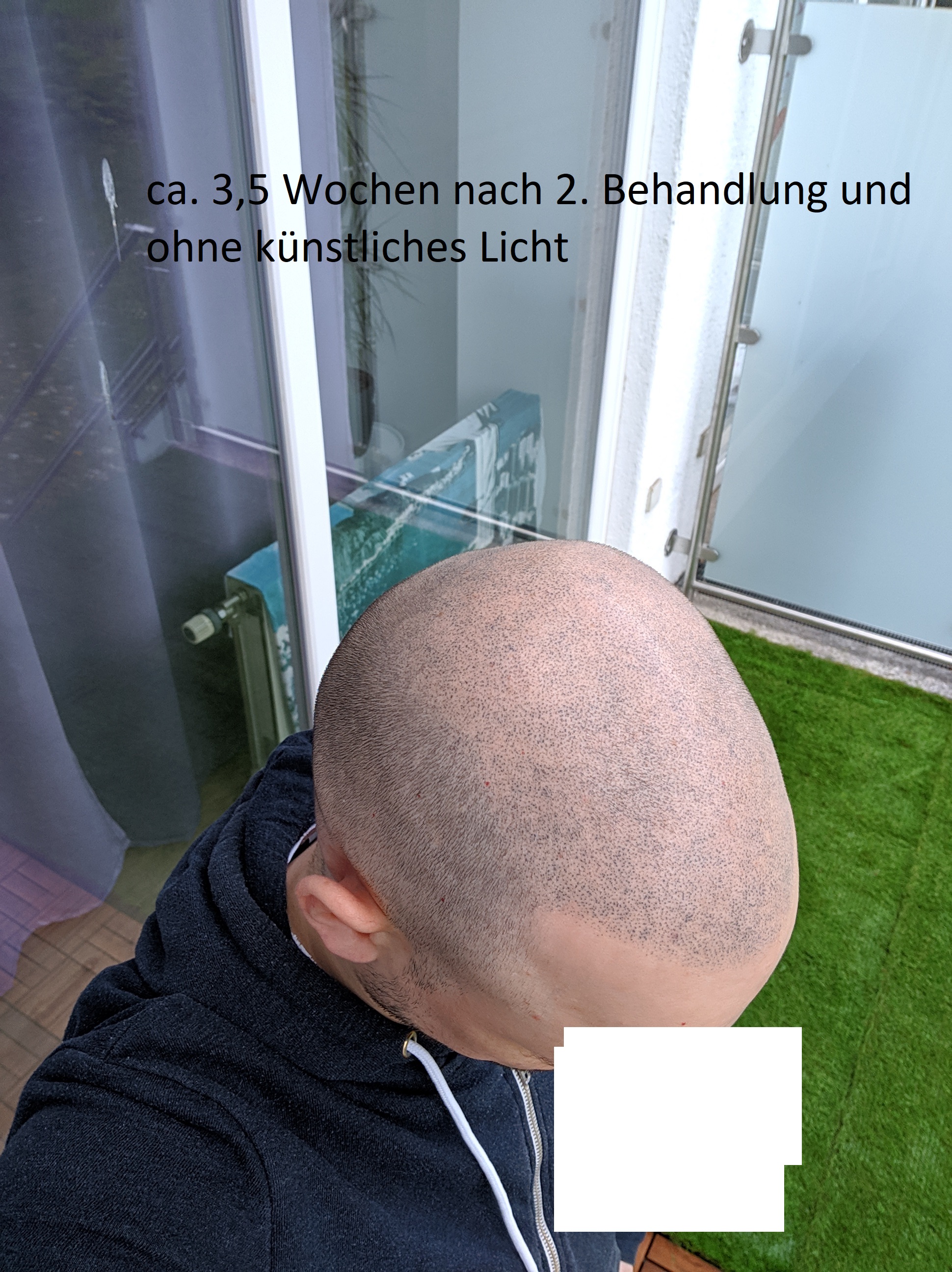 /foren/transplant/index.php?t=getfile&id=42613&private=0