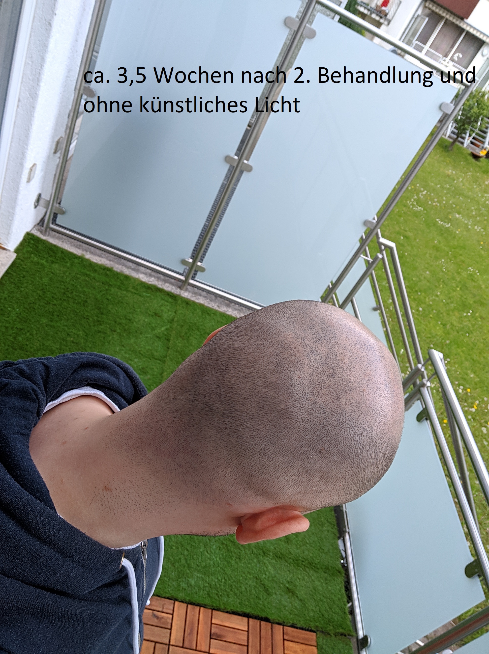 /foren/transplant/index.php?t=getfile&id=42614&private=0