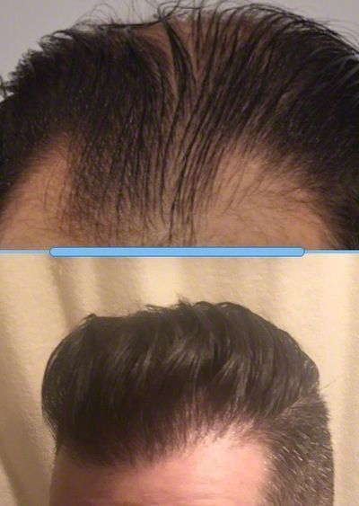 /foren/transplant/index.php?t=getfile&id=42670&private=0