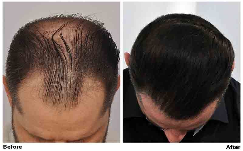 /foren/transplant/index.php?t=getfile&id=42671&private=0