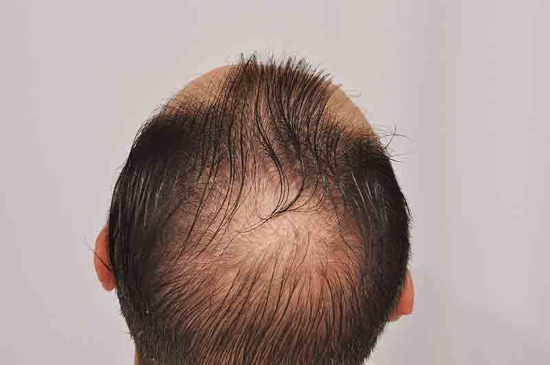 /foren/transplant/index.php?t=getfile&id=42672&private=0