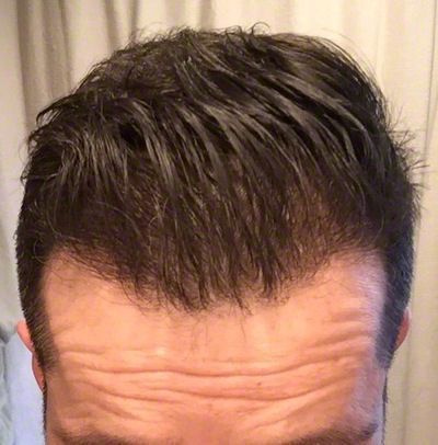 /foren/transplant/index.php?t=getfile&id=42675&private=0