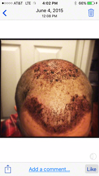 /foren/transplant/index.php?t=getfile&id=42677&private=0