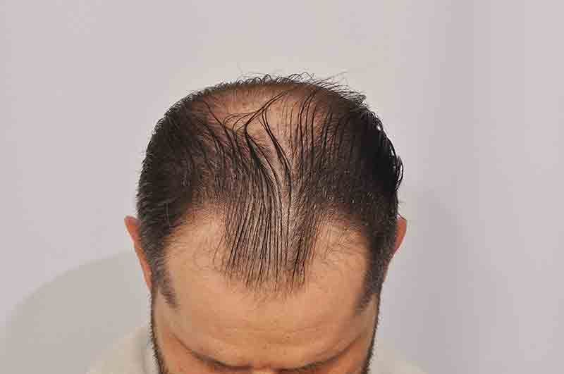 /foren/transplant/index.php?t=getfile&id=42678&private=0