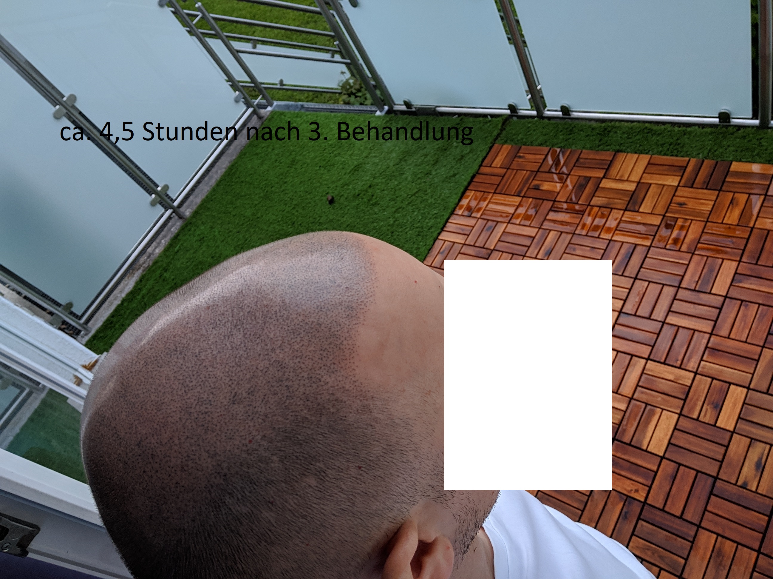 /foren/transplant/index.php?t=getfile&id=42721&private=0