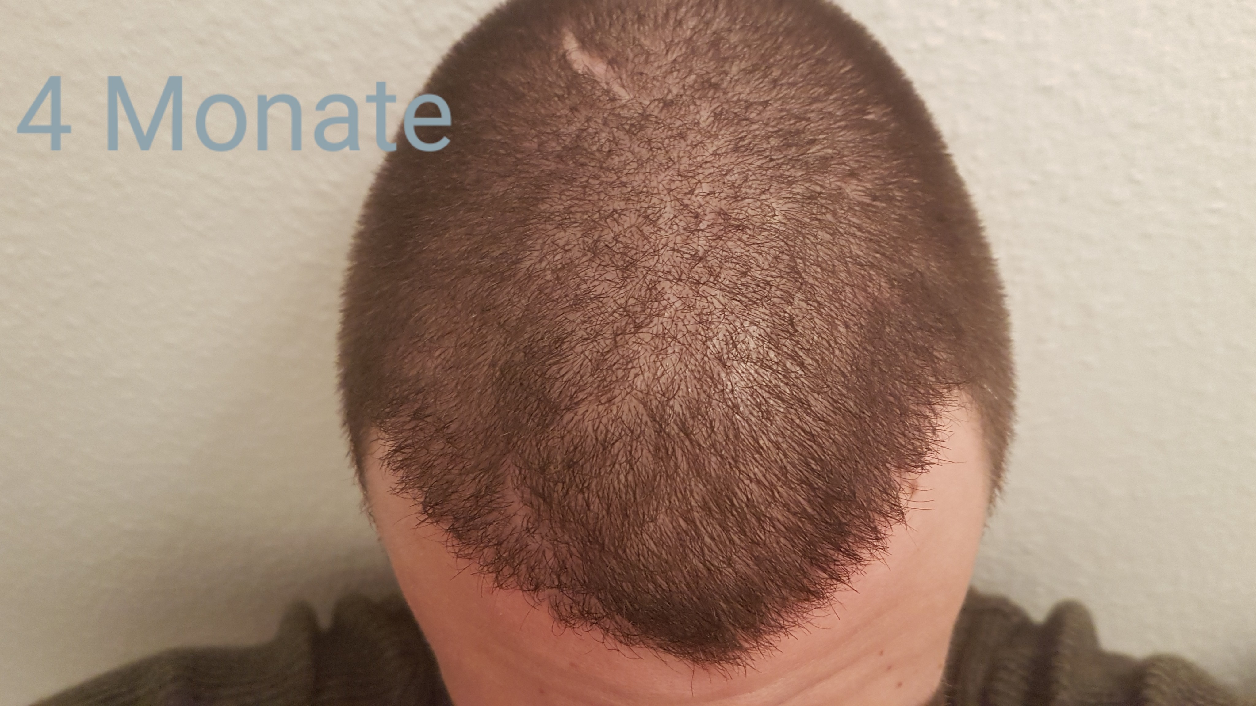 /foren/transplant/index.php?t=getfile&id=42829&private=0