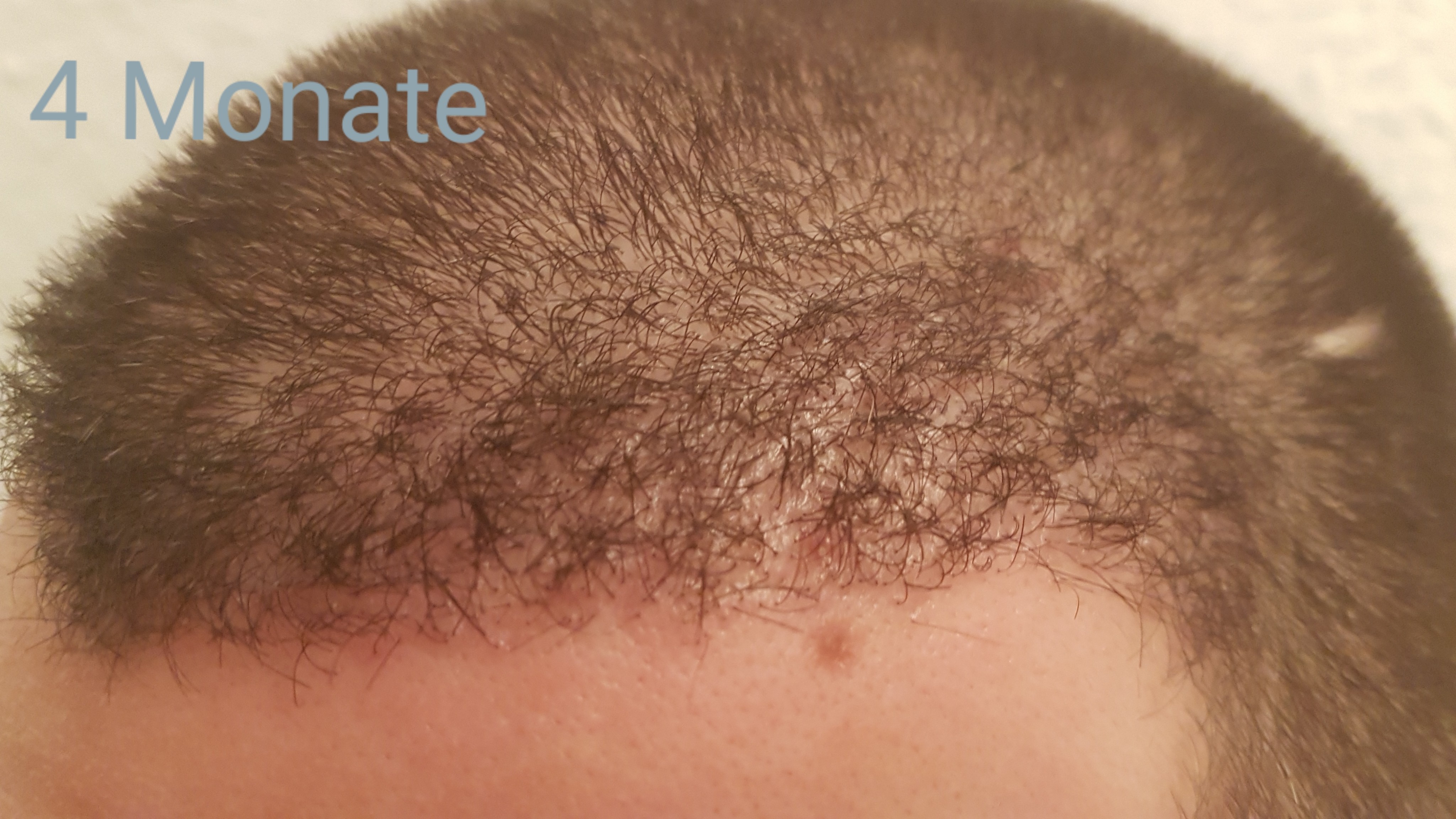 /foren/transplant/index.php?t=getfile&id=42830&private=0