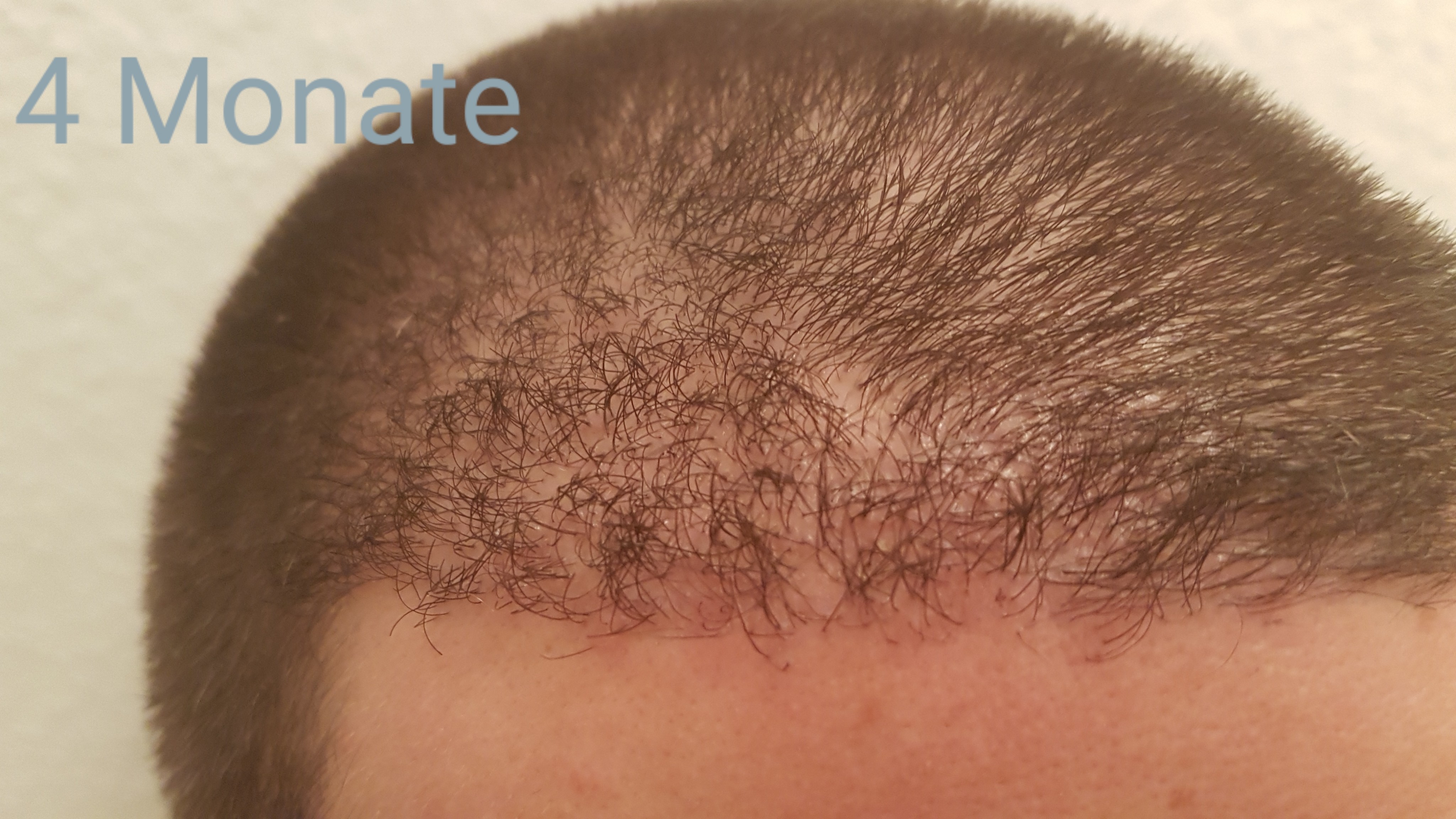 /foren/transplant/index.php?t=getfile&id=42831&private=0