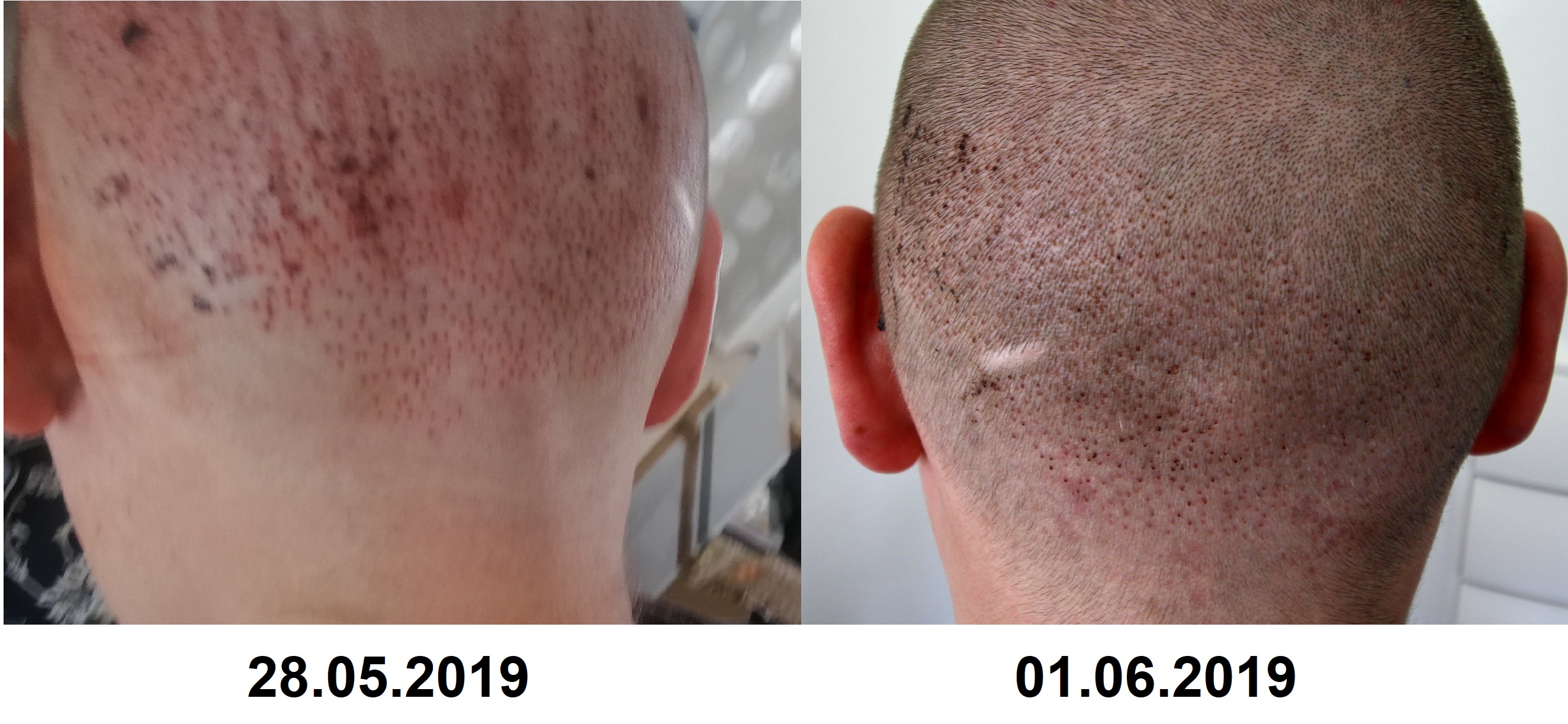 /foren/transplant/index.php?t=getfile&id=42945&private=0