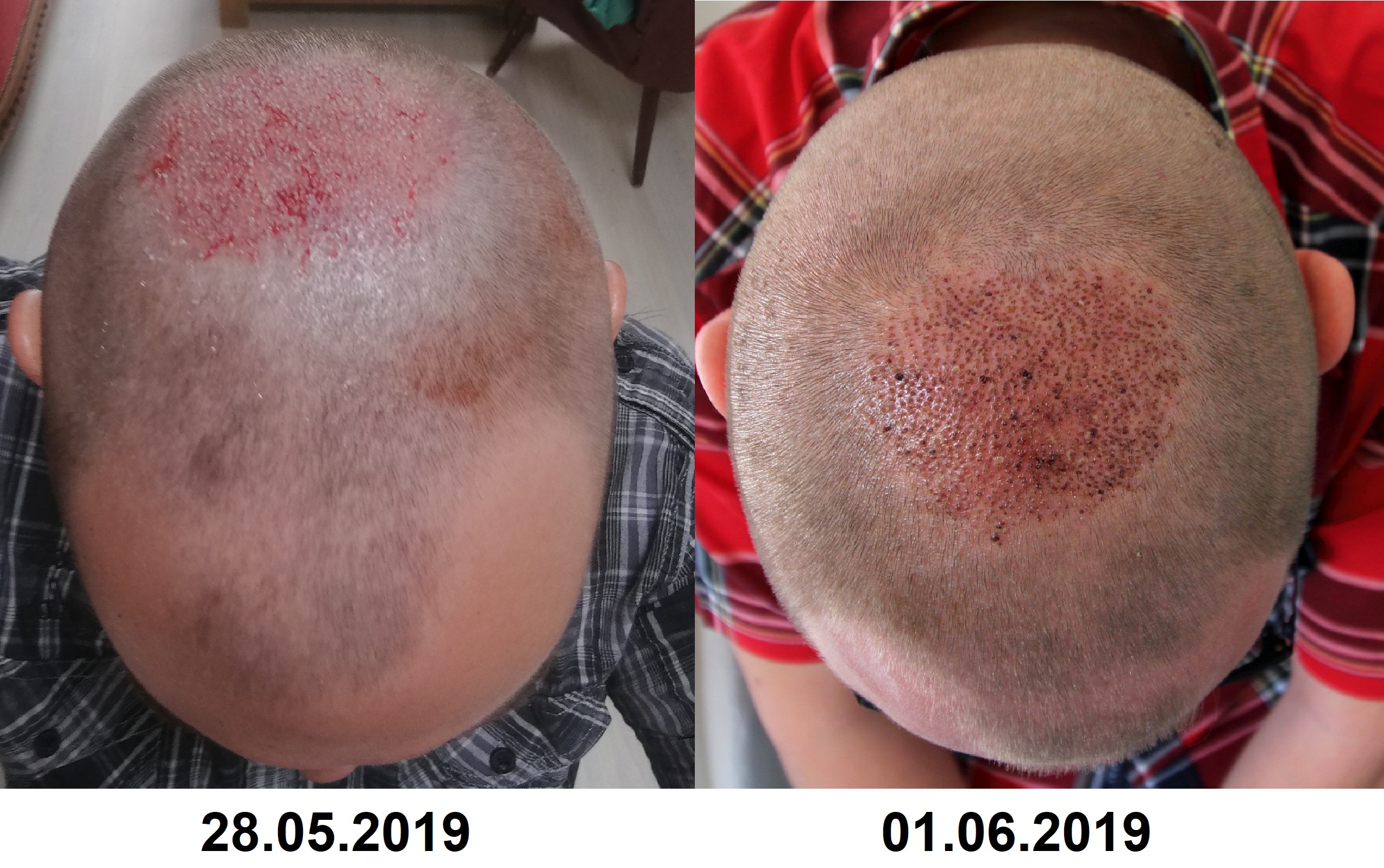 /foren/transplant/index.php?t=getfile&id=42946&private=0