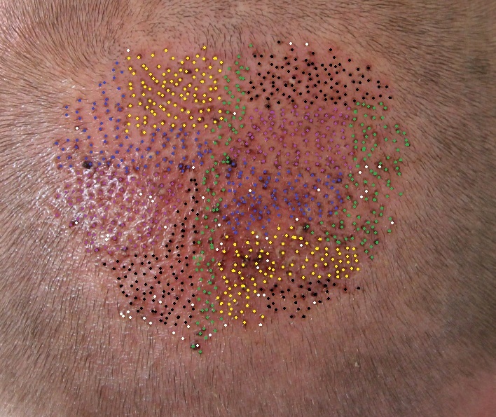 /foren/transplant/index.php?t=getfile&id=42948&private=0