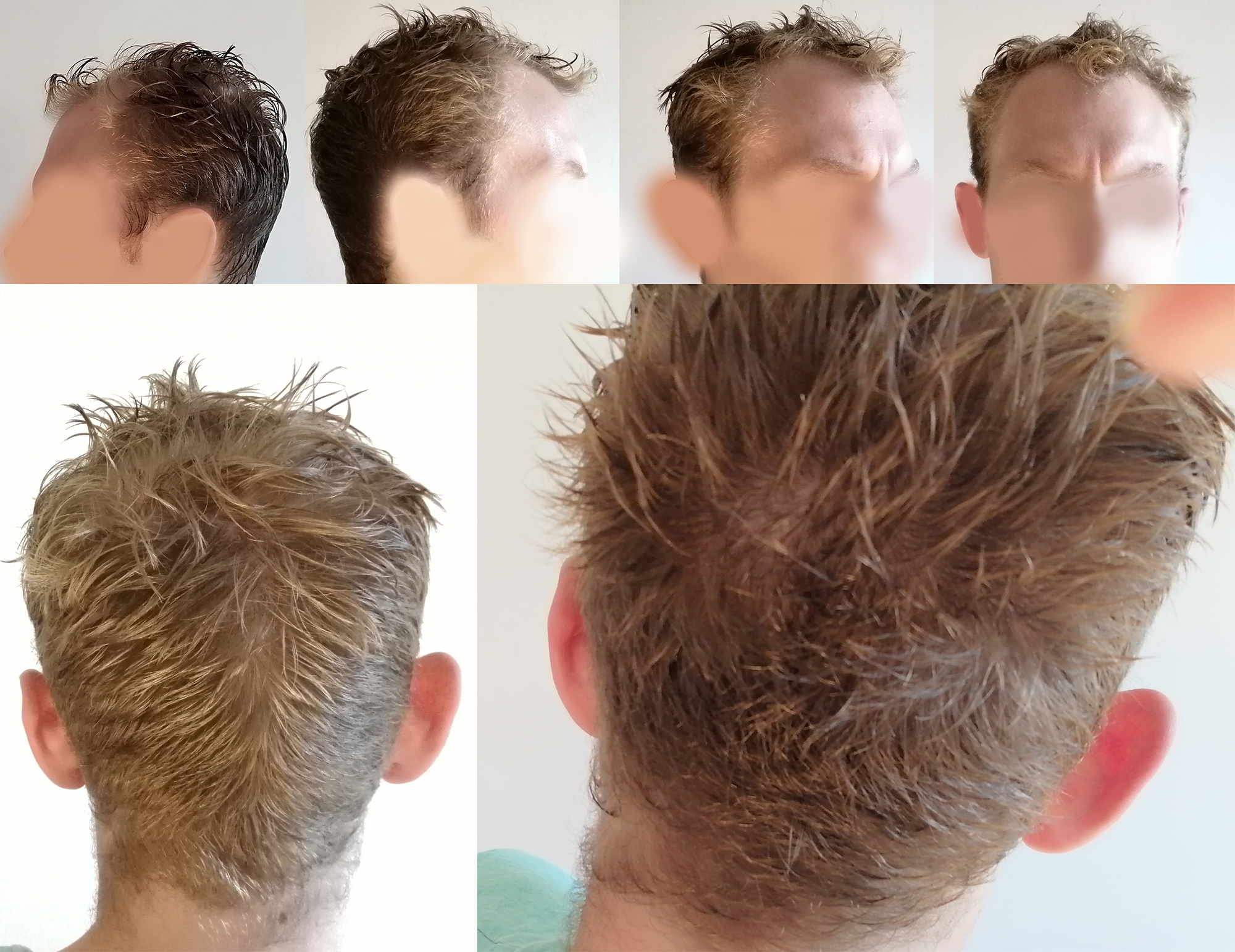 /foren/transplant/index.php?t=getfile&id=42978&private=0