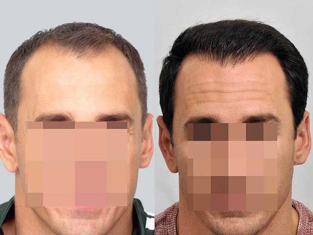 /foren/transplant/index.php?t=getfile&id=42982&private=0