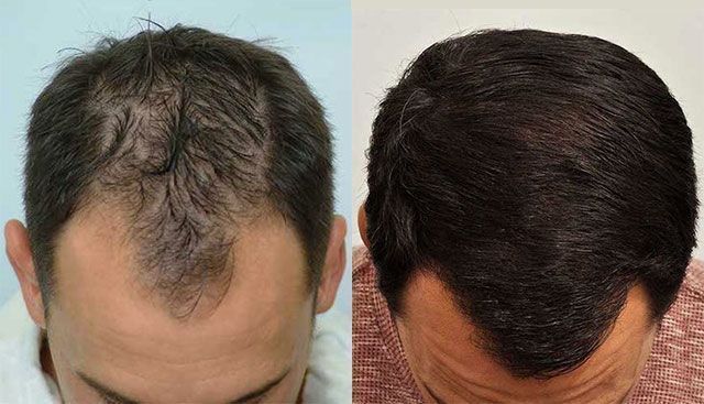 /foren/transplant/index.php?t=getfile&id=42983&private=0