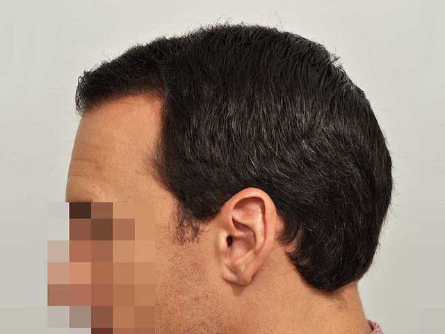 /foren/transplant/index.php?t=getfile&id=42984&private=0