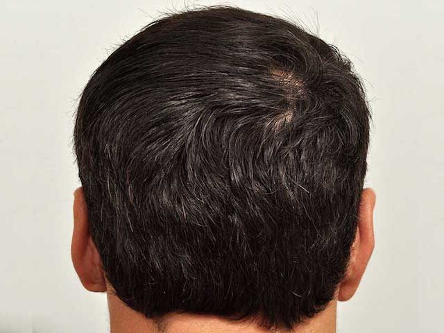 /foren/transplant/index.php?t=getfile&id=42987&private=0