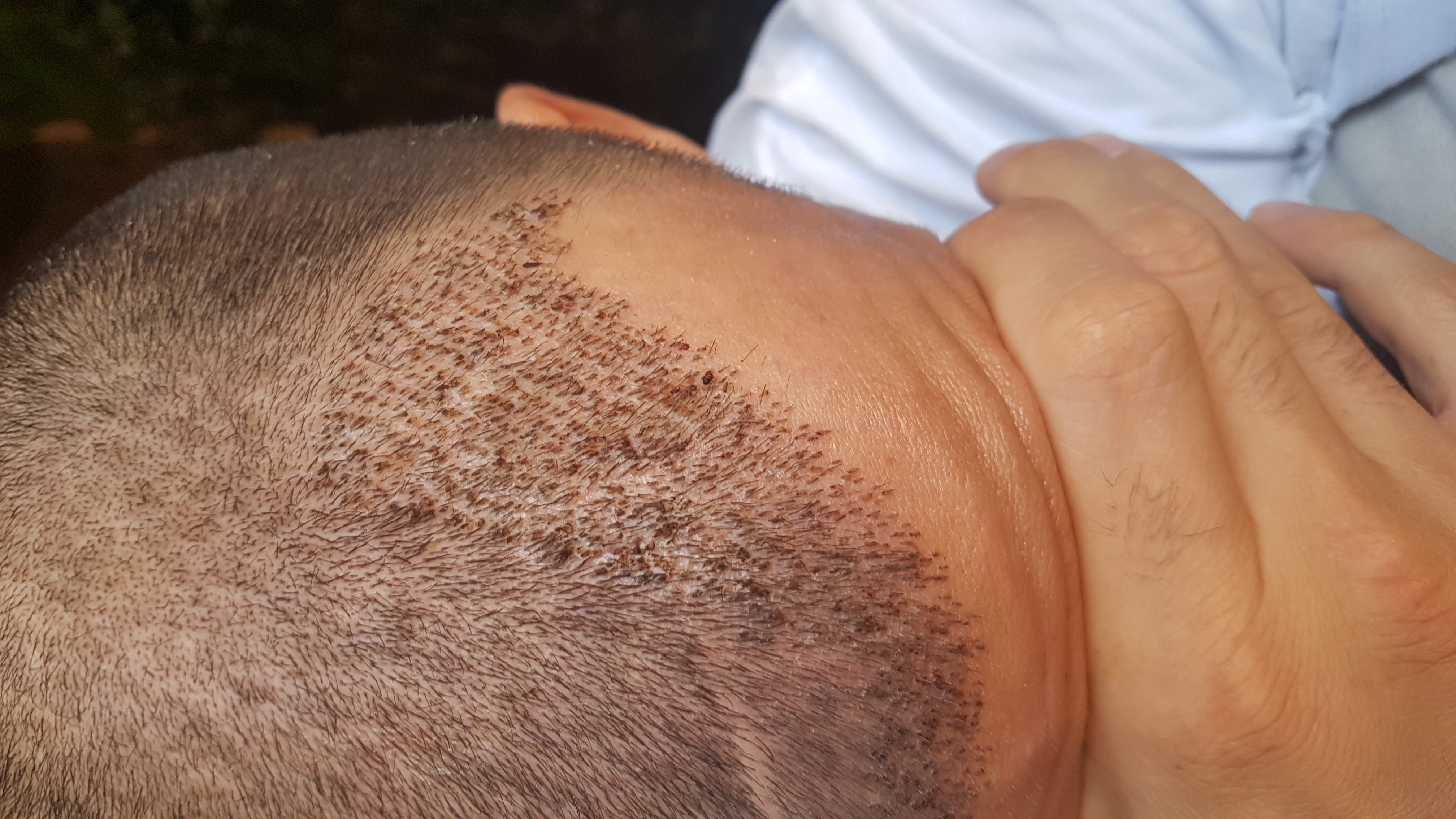 /foren/transplant/index.php?t=getfile&id=43059&private=0