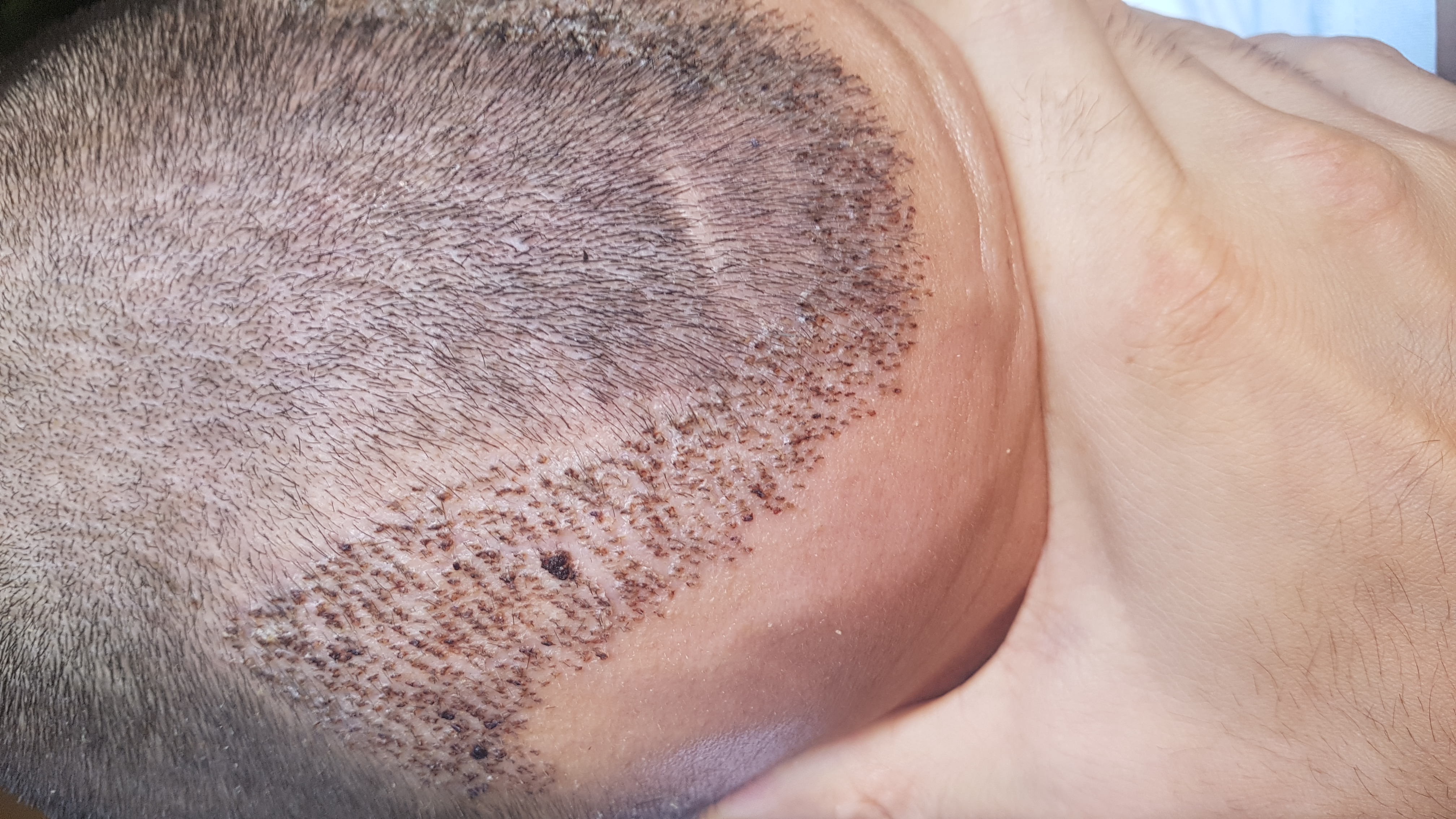 /foren/transplant/index.php?t=getfile&id=43060&private=0