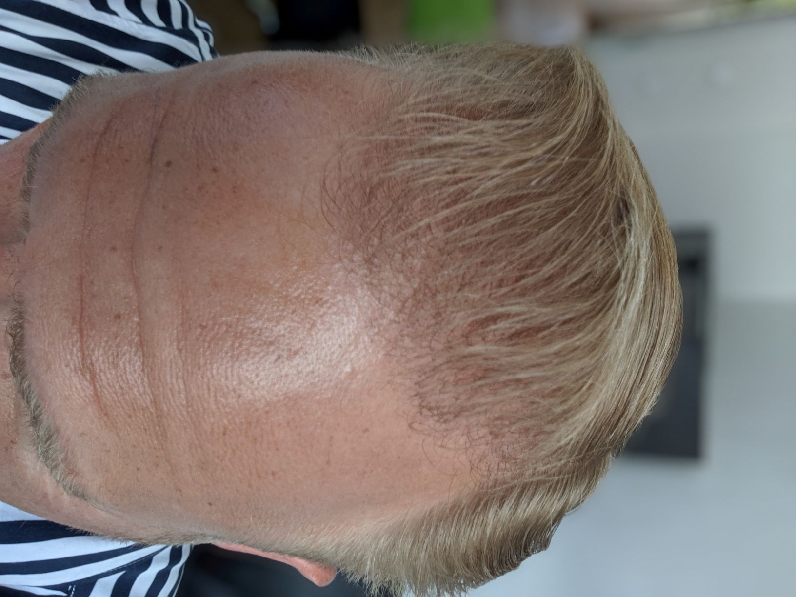 /foren/transplant/index.php?t=getfile&id=43072&private=0