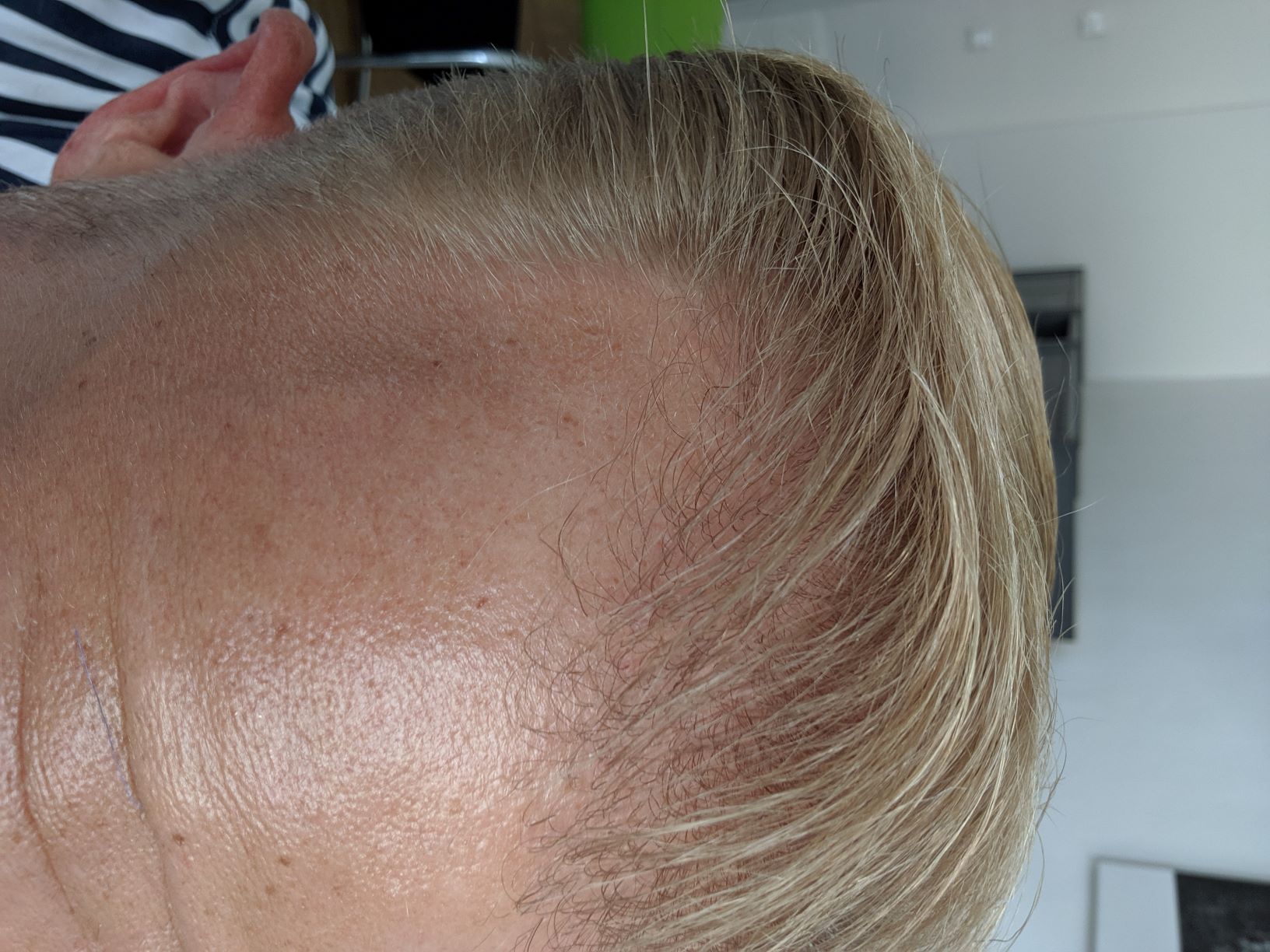 /foren/transplant/index.php?t=getfile&id=43074&private=0