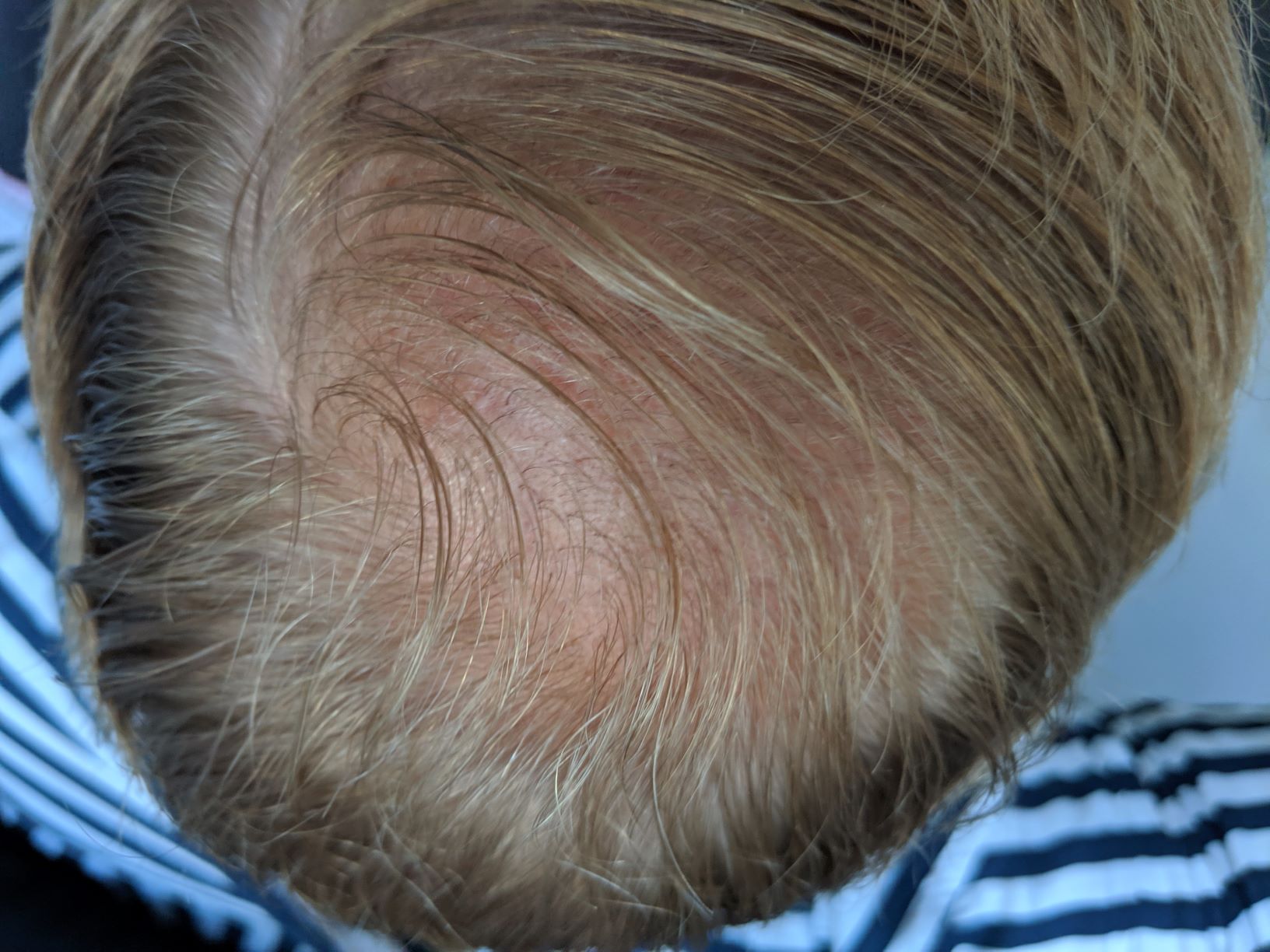 /foren/transplant/index.php?t=getfile&id=43076&private=0