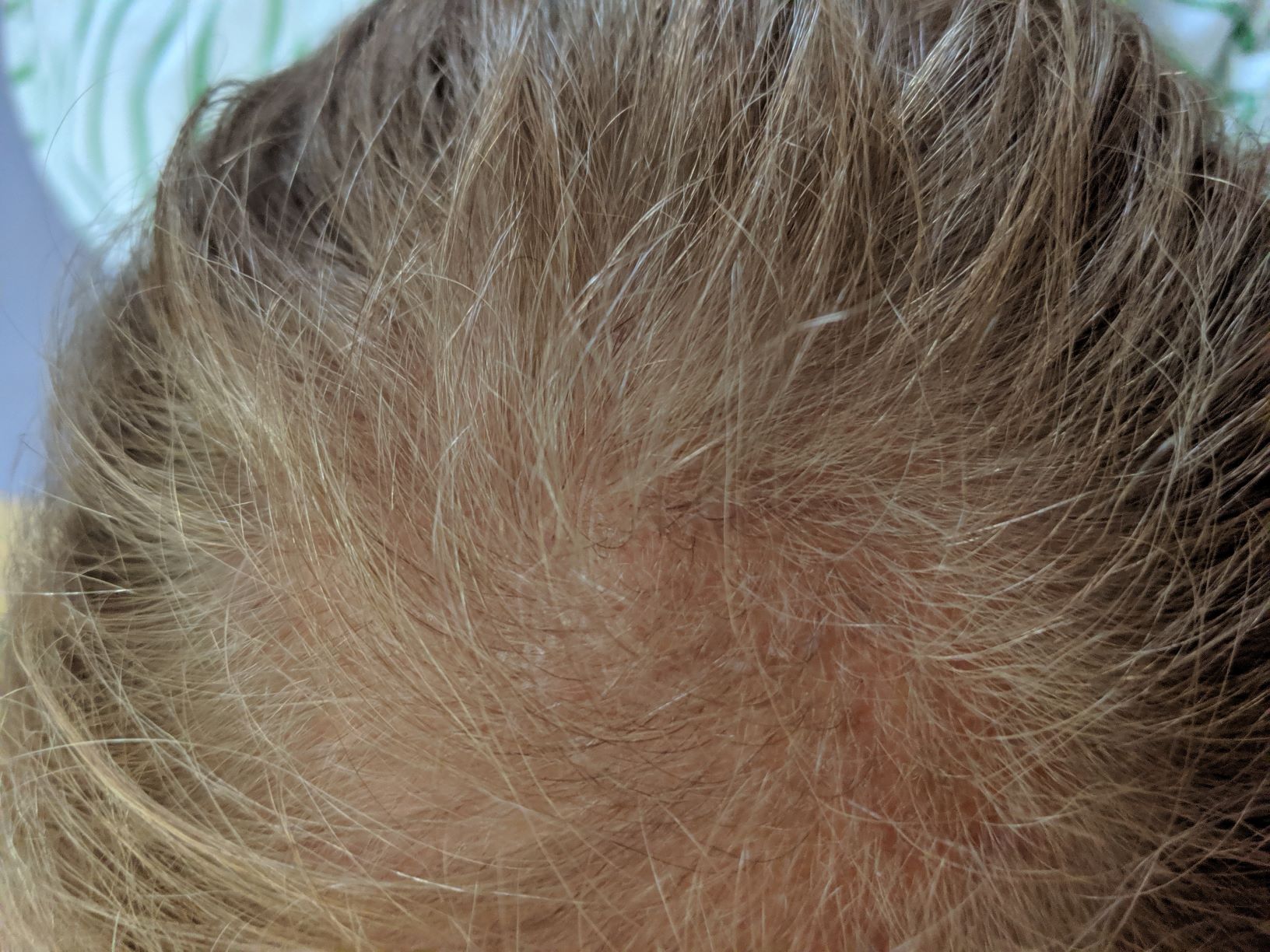 /foren/transplant/index.php?t=getfile&id=43080&private=0