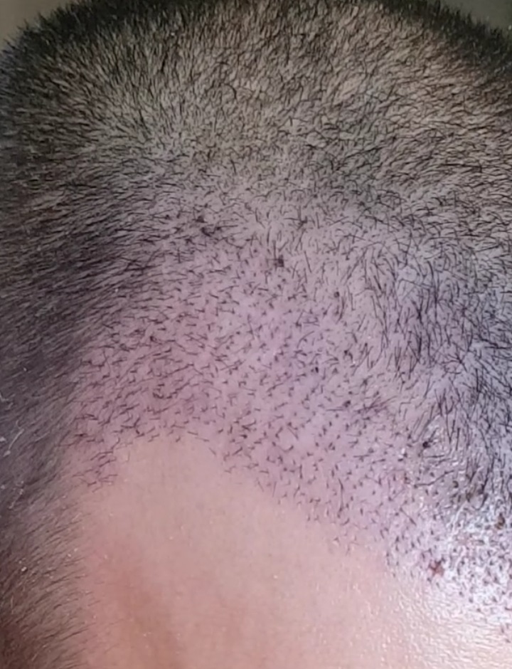 /foren/transplant/index.php?t=getfile&id=43088&private=0