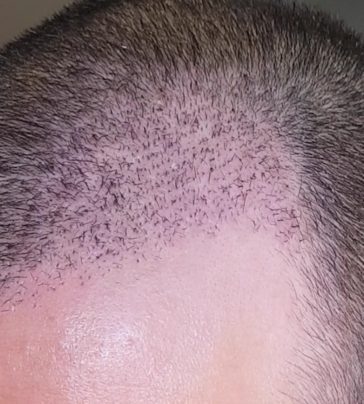 /foren/transplant/index.php?t=getfile&id=43089&private=0