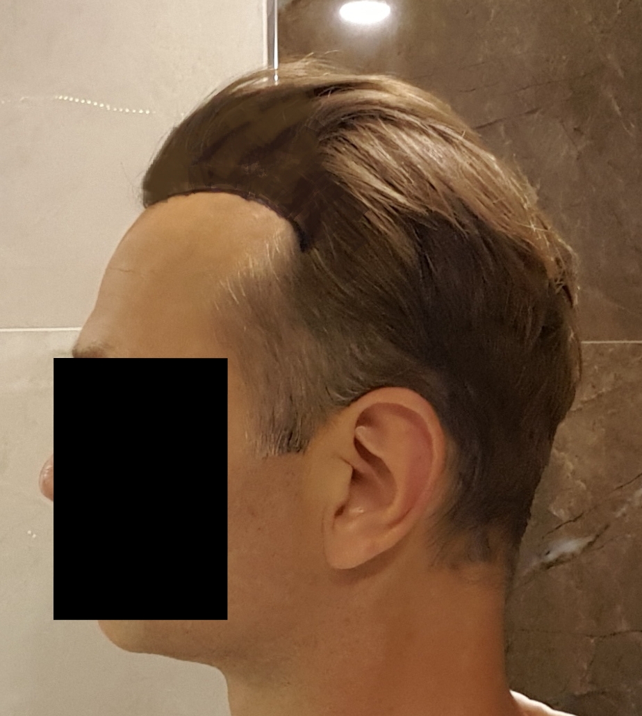 /foren/transplant/index.php?t=getfile&id=43295&private=0