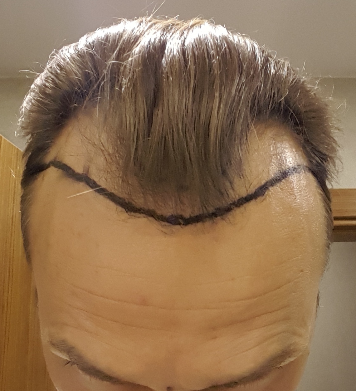 /foren/transplant/index.php?t=getfile&id=43296&private=0