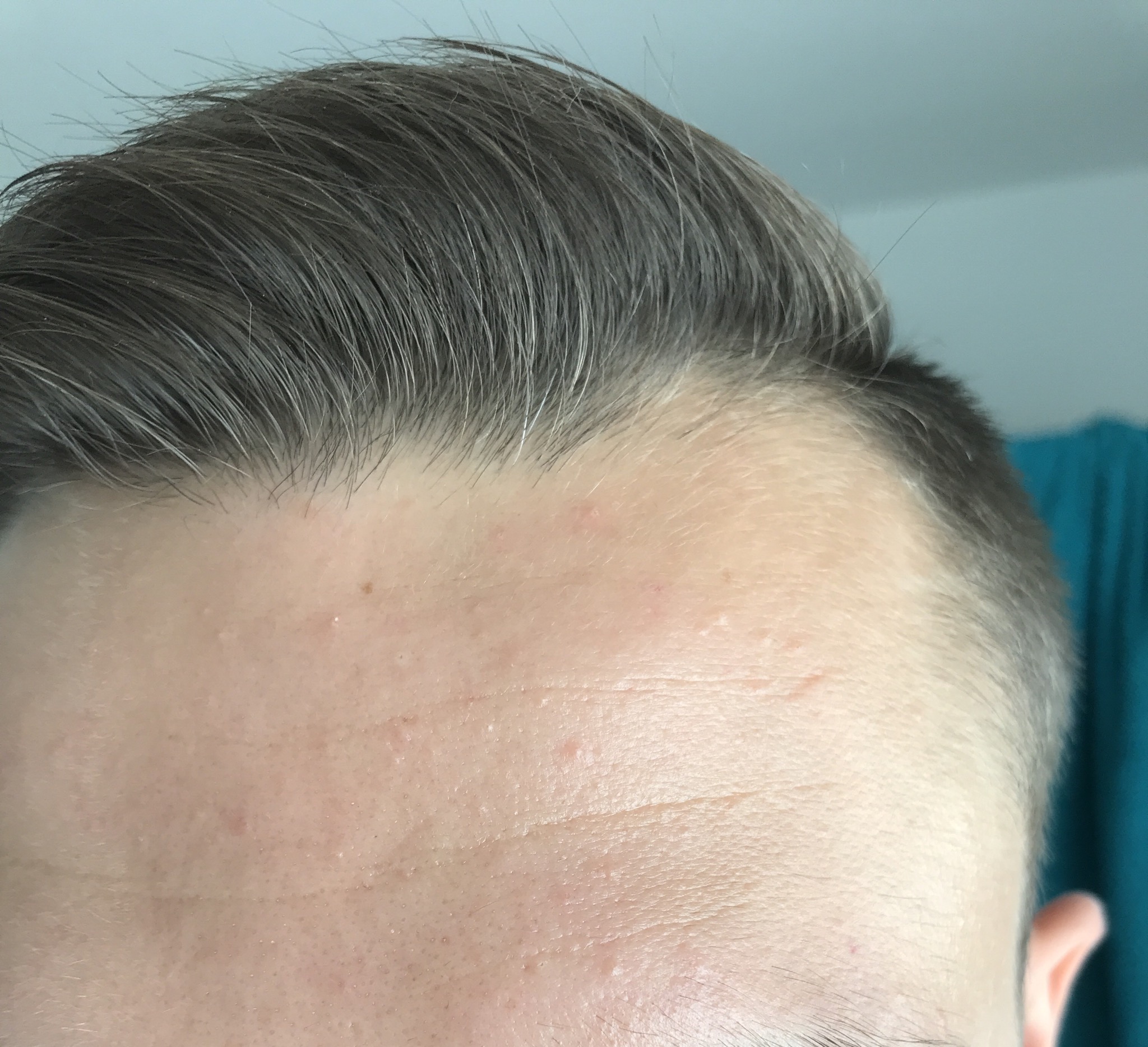 /foren/transplant/index.php?t=getfile&id=43365&private=0