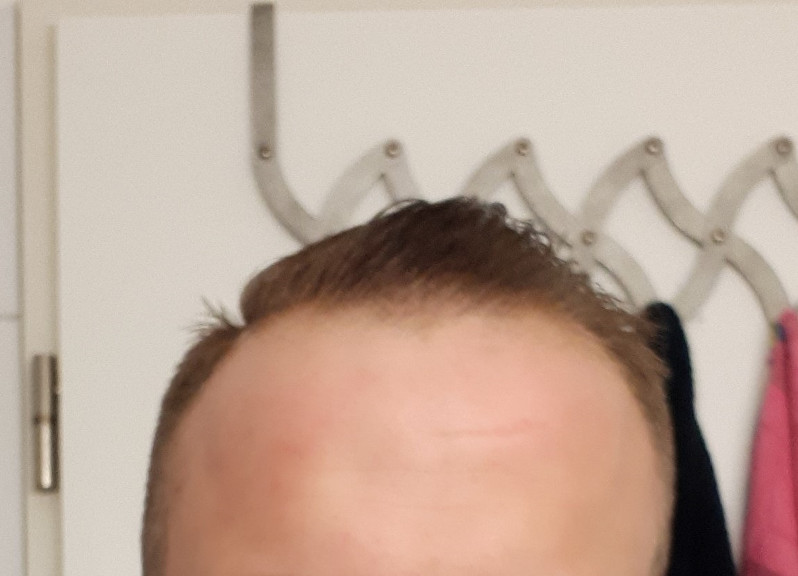 /foren/transplant/index.php?t=getfile&id=43458&private=0