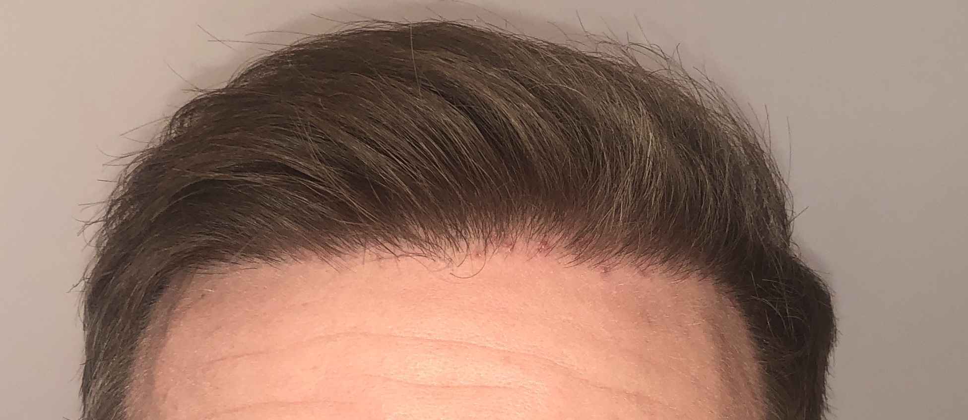 /foren/transplant/index.php?t=getfile&id=43557&private=0